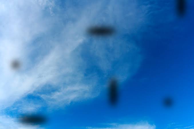 Mosche volanti e lampi di luce: quando è necessario fare una visita oculistica?