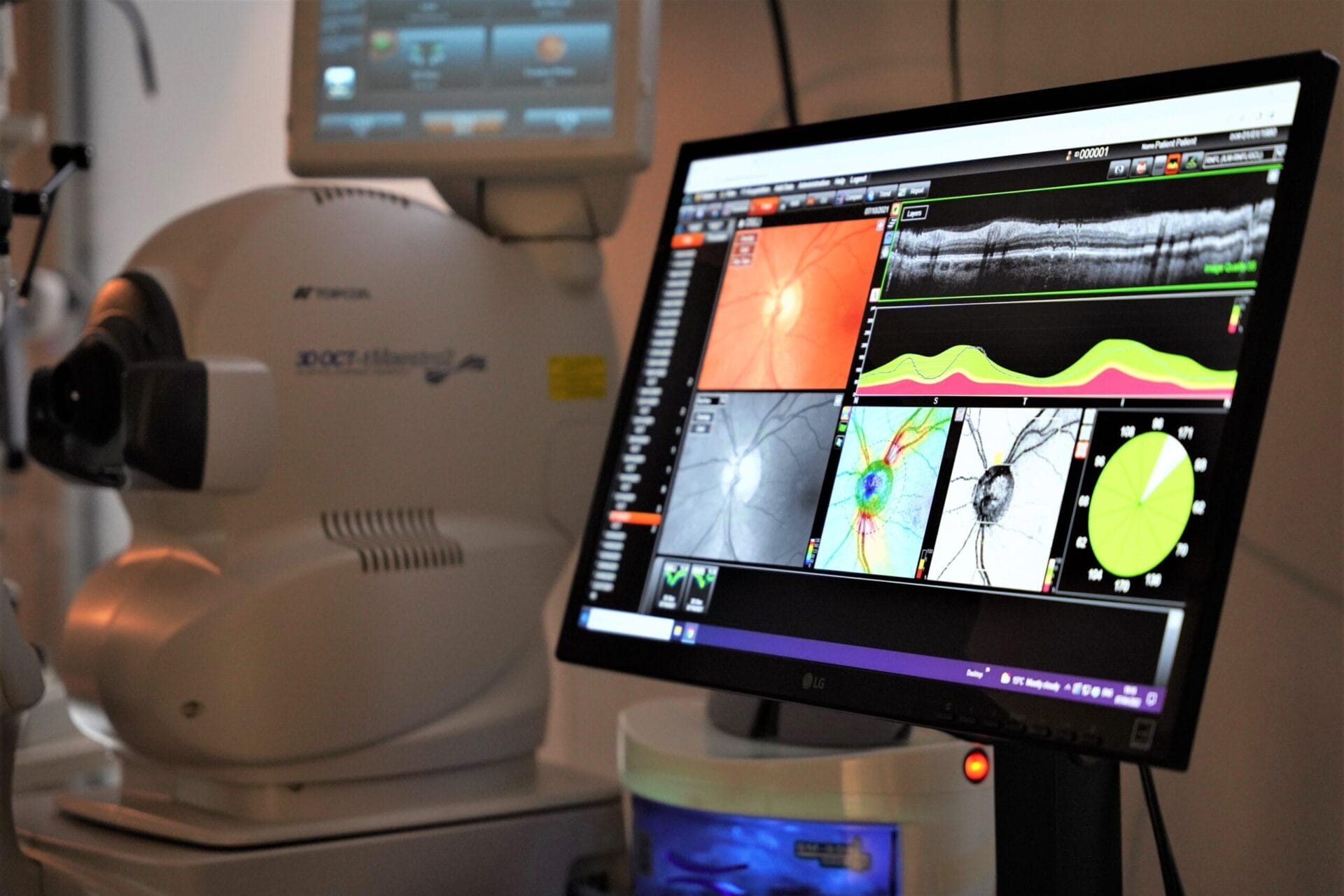 OCT reale della retina e della macula eseguito con strumentazione in studio